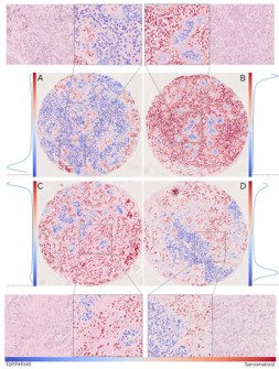 Tissue microarray cores with colour-mapped goblet cell segmentation